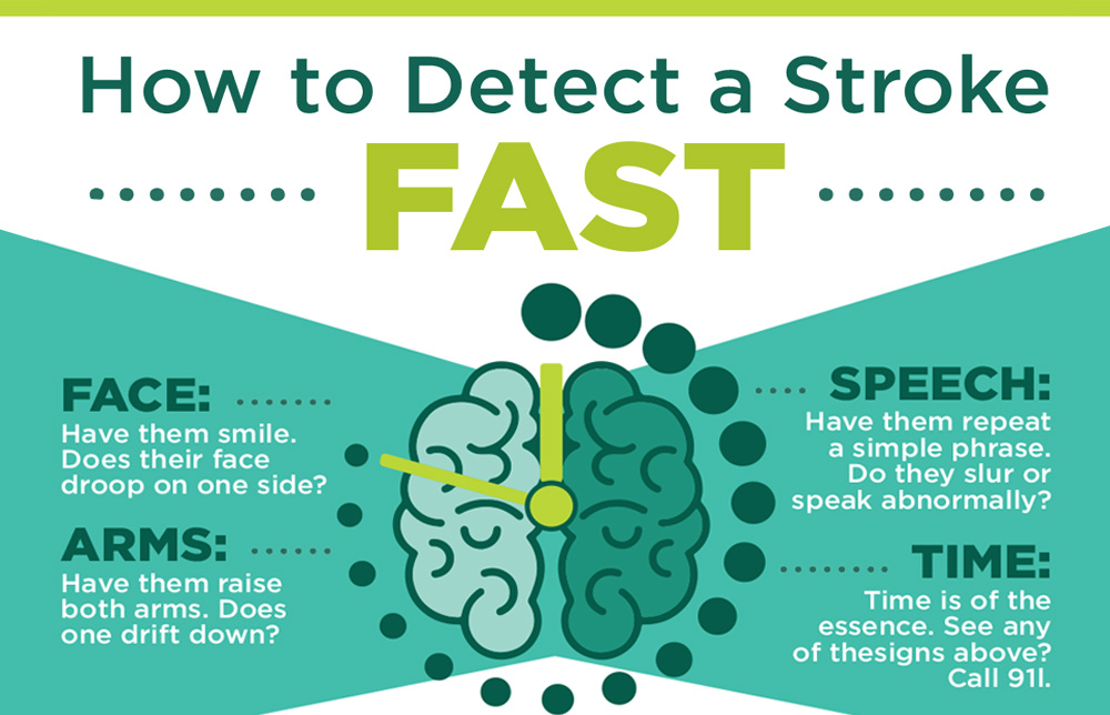 Fast Stroke Method